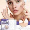 dark spotremoval patch Helps improve black spots and soothes the skin for all Skin Colors (288 Counts) 2 pcs view 2