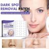 dark spotremoval patch Helps improve black spots and soothes the skin for all Skin Colors (288 Counts) 2 pcs view 3