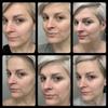 TC 10% Gel Peel, Chemical Peel for Face Breakout Scars, Chemical Exfoliant for Face, Strength Level 2, 1.0 fl oz. e, 30 mL  Kiaeva Cosmetics (10) view 2
