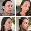 TC 10% Gel Peel, Chemical Peel for Face Breakout Scars, Chemical Exfoliant for Face, Strength Level 2, 1.0 fl oz. e, 30 mL  Kiaeva Cosmetics (10) view 4
