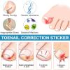 50Pcs Ingrown Toenail Correction Strips - Plant-Based Toenail Support | Ingrown Toe Nail Care Stickers for Quick Discomfort Relief, Promote Natural Growth, Breathable & Easy to Apply for Daily Use view 2
