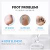 Natural Honey Urea Foot Cream, Deep Moisturizing Treatment for Cracked Heels and Dry Feet (0.70oz) view 3