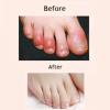 Natural Honey Urea Foot Cream, Deep Moisturizing Treatment for Cracked Heels and Dry Feet (0.70oz) view 4