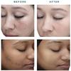 TC 25% Gel Peel, Chemical Peel for Face Breakout Scars, Chemical Exfoliant for Face, Strength Level 2, 1.0 fl oz. e, 30 mL  Kiaeva Cosmetics (25) view 3