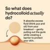 Meiiyo NOOD Pimple Patch  Skin-Tone Matching, Ultra-Thin & Breathable Hydrocolloid | Discreet Pimple Coverage & Fast Healing | 20 Patches in 2 Sizes (Sandstone) view 3