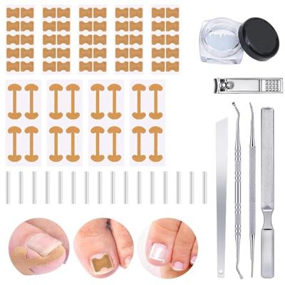 Ingrown Toenail Corrector Set with Correction Strips, Toenail Lifter & File, Professional Pedicure Tools Kit for Ingrown & Curved Toenails for Women & Men (1 Set)