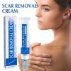 2Pcs Squalane & Centella Scar Cream - Silicone Scar Gel Formula for New & Old Scars, Fades Acne, Surgery, C-Section Marks & Keloid Bumps, Soothes Skin with Shea Butter & Aloe view 2