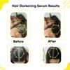 M.a.s.o.f.t.a Anti Grey Hair Darkening Serum | Reverses & Limits Hair & Beard Greying | Promotes Shinier Hair | With Arcolys, Melano Gray, Biotin & Bhringraj For Both Men & Women, 30ml. view 4