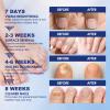 Toenail Fungus Treatment Extra Strength - 42 Pcs Fungal Nail Patches, nail repair patches-8-Hour Firm Adhesion, Nail Repair patches for Damaged Nails, Overnight Renewal for Men and Women view 3