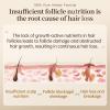 Dr.Ville Hair & Scalp Nourishing Spray  Lightweight Formula for Shiny, Soft, and Healthy-Looking Hair view 3