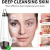 Blackhead Remover Pore Vacuum, Visual Rechargeable Blackhead Vacuum Facial Pore Cleaner-3 Suction Soft Silicone,3 Probes,USB Kit Electric Acne Extractor Tool for Adult view 2
