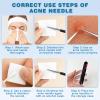 Blackhead Remover Tool Kit  4-Piece Stainless Steel Acne & Pimple Set | Whitehead & Zit Extractor with Non-Slip Handles 2 Sets view 3