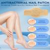 Nail Patches Toenail Treatment Extra Strength 8-Hour Overnight Nail Fast Acting Repair Effortless Hydrogel Nail Care and Repair for Damaged Nails Overnight Renewal for Men and Women (48 Count) view 2