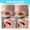 Medech 3PCS Nasal Hair Cutter Portable Travel Essentials,2026 Manual 360 Rotating Nostril Hair Removal Tools Double Sided Nose Hair Blade,Nose Hair Cutter for Women Men (Blue, 3 Pack) view 2