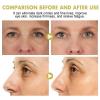 futiu Mineral Oil Eye Stick - Hydrating Treatment To Minimize Puffiness & Fine Lines, Nourish Delicate Eye Area(#2,3pcs) view 2