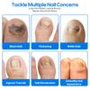 Nail Repair Patches for Toenails Overnight Toenail Patches for Damaged Nails, Soft Toe Nail Bandaid Style Nail Patches for Gentle Nail Care, Daily Toenail Repair & Nail Renewal, 21 Pcs view 3