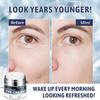 Day & Night Eye Cream with 6% Caffeine, Collagen, Retinol & Niacinamide - Anti-Aging, Deeply Moisturizing and Firming Eye Cream for Dark Circles, Puffiness, Fine Lines & Wrinkles, 1.76oz view 3
