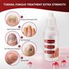 DERMFREE Toenail Treatment,Gentle Formula, Effectively Improves Nails for a More Beautiful Appearance2pcs view 2