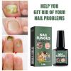 Cure nail Fungus Treatment Extra Strength,Gray Nail Liquid External Use Health Care Hand and Foot Thickening Brightening Gray Nail Foot Care Liquid15ml view 2