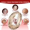 DERMFREE Fungi Nail ToenailTreatment,Gentle Formula,Effectively lmproves Nails for a More Beautiful Appearance (1PCS, 0.5 FL OZ) view 2