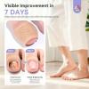 SAVILAND Fungal Nail Patches 32 PCS FSA-HSA Extra Strength: 8H Overnight Repair 1% Tolnaftate Toenail Treatment Nighttime Nail Renewal Restores Damaged Nails Discolored Thick Yellow view 4