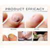 Bee Venom Spray, Advanced Bee Venom Toenail Repair Spray - Nail Treatment for Damaged Nails, Soothing, Nourishing & Moisturizing Formula, Safe & Gentle Nail Care Solution (1PCS) view 4