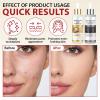 Black Rice Exfoliant and White Rice Peeling Glow Ampoule 100ml, 2 PCS White & Black Rice Facial Serum, Soft Exfoliating Face and Body Dead Skin Cells for All Skin Types view 3