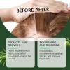 | Biotin | Hair Growth Supplement | Skin Care | Rosemary Hair Growth Essential Oil Promotes Healthy and Nourishing Hair Growth, Tough Hair Essential Oil Hair (3.38 Fl Oz) view 3