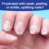 2PCS Bee Venom Ginger Nail Treatments, 7 Days Ginger Cuticle Care Oil for Nails for Strengthen nails & Promote Nail Growth view 2