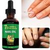 2PCS Bee Venom Ginger Nail Treatments, 7 Days Ginger Cuticle Care Oil for Nails for Strengthen nails & Promote Nail Growth view 3