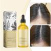 Castor Oil Hair Thickening Essence - Scalp & Hair Repair, Moisturizing & Smoothing Oil view 3