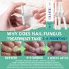 Nail Fungus PenNail Growth & Repair Essence Pen, specifically designed for fungal infections on toenails and fingernails. Repairs and strengthens nails, revealing smooth and glossy nails3pcs view 3