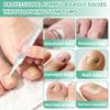 Nail Fungus PenNail Growth & Repair Essence Pen, specifically designed for fungal infections on toenails and fingernails. Repairs and strengthens nails, revealing smooth and glossy nails3pcs view 4