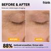 Excuse My Frank - Bakuchiol Age Defense Eye Cream Correction for Puffy Eye Bags Fine Lines Dark Circles Wrinkles, Korean Skin Care (1 Pack) view 3