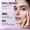 Excuse My Frank - Bakuchiol Age Defense Eye Cream Correction for Puffy Eye Bags Fine Lines Dark Circles Wrinkles, Korean Skin Care (1 Pack) view 4