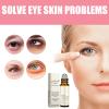 10s Wrinkle Serum,Instant Face Lift Serum,Anti-Wrinkle FirmingSerum,Pure Natural Plant Essence,Deeply Hydration,For Dark Circles, Eye Bags And Puffiness (4PC) view 2