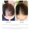 Dr. Groot Scalp Revitalizing Solution Scalp Happiness Set  LIMITED EDITION HOLIDAY SET view 4