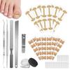 Ingrown Toenail Corrector Set with Correction Strips, Professional Ingrown Toenails Pedicure Tool Set, Painless File and Lifter Pedicure Tools Pedicure Tools,Ingrown Nail Tool for Women Man. view 1