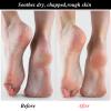 3 Pairs Foot Moisturiser Socks Overnight, Spa Cotton Socks for Foot Cream, Lotion Sock for Moisturising for Dry Feet Care, Moisturising Sock for Cracked Heel Repair Women Men (Pink) view 3