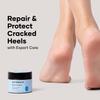 Cureskin Foot Care Cream for Cracked Heels | Repairs, Softens, and Exfoliates | Foot Cream for Women and Men, 50 g (Pack of 1) view 2