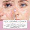 Rapid Tone Repair Retinol + Vitamin C Dark Spot Corrector Face Serum, Daily Anti-Wrinkle Dark Spot Corrector to Brighten & Even Tone, Mineral-Oil & Dye-Free, White, 1 oz view 3