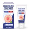 AKQBPN Folliculitis Treatment Cream, Comfort for Itching & Redness, Natural Non-Irritating, Scalp Face and Body, 2Oz view 1