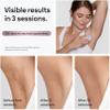 Braun IPL Mini, SilkExpert Mini, IPL Hair Removal for Women and Men, Permanent Laser Hair Reduction At-Home, IPL1111 view 3