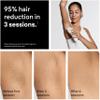 Braun IPL, SilkExpert Pro 5, IPL Hair Removal for Women and Men, Permanent Laser Hair Reduction At-Home, 1 Head, IPL5100 view 4