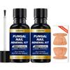 Toenail Fungus Treatment Extra Strength: 25% Undecylenic Acid & Tea Tree Oil - Repairs Yellow Thick Brittle Toe and Fingernails - 2 Bottles with 14 Patches view 1
