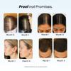 Growplex Revive Shampoo and Replenish Conditioner Bundle Kit, 300 mL Each | Daily Scalp Care for Fuller Looking Thicker Looking Hair view 3