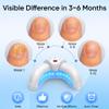 Home Toenail Repair Treatment for Multiple Toenails & Fingernails, Three Modes view 3