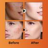 MACARIA Miracle Beauty Papaya Daily Routine face wash Cleanser for Acne for women view 4