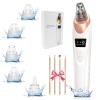 2026 Pore Vacuum, USB Rechargeable Blackhead Remover Vacuum,3 Levels Adjustable Pore Vacuum Blackhead Remover, with 5 Suction Power,6 Probes,Face Vacuum Pore Cleanser for Women & Men-White view 1