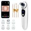 2026 Pore Vacuum with Camerafor, USB Rechargeable Blackhead Remover Vacuum,3 Levels Adjustable Pore Vacuum Blackhead Remover, 6 Suction Heads,Face Vacuum Pore Cleanser for Women & Men-White view 1